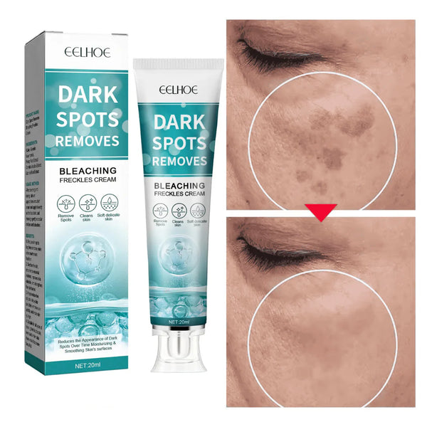 Peria magică pentru Blanoşi